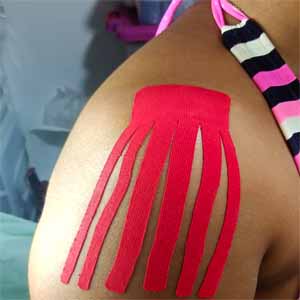 Kinesiotape